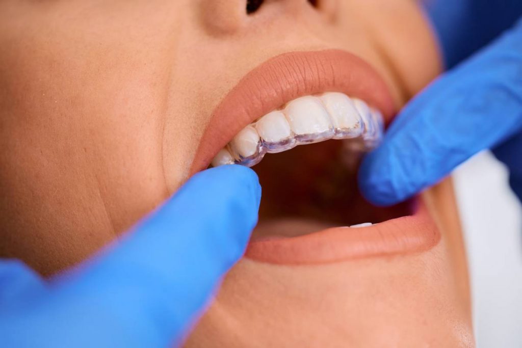 Close up of woman getting invisible teeth aligners at dentist's office.