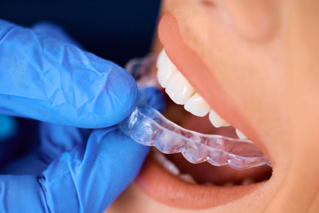 Close up of woman receiving transparent braces on her teeth at dentist's office,